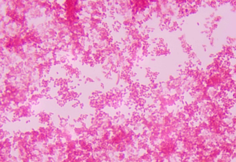Yersinia Pestis, das Pestbakterium unter dem Mikroskop